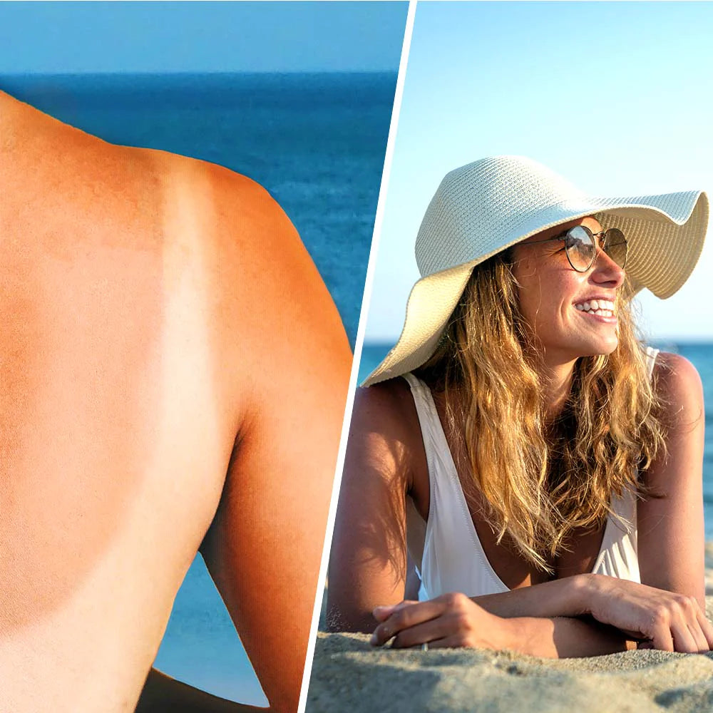 Успокояващ лосион спрей с хиалуронова киселина след слънце - 200 мл - Feel You