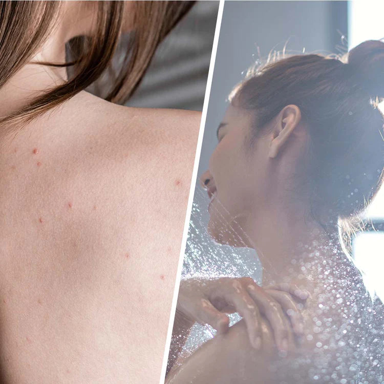 Салицилова скраб с чаено дърво за детоксикация на кожата 250 мл - Feel You