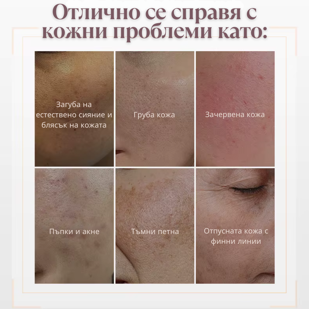 4D LED маска за лице с фотонна терапия x 4 типа светлина - Feel You
