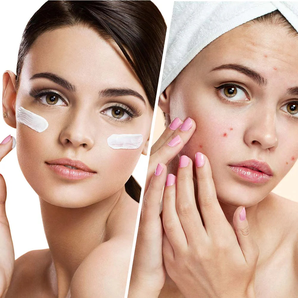 Clear Balance – Хидратиращ крем за лице против пъпки и несъвършенства с ниацинамид 50 мл - Feel You