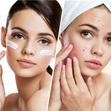 Clear Balance – Хидратиращ крем за лице против пъпки и несъвършенства с ниацинамид 50 мл - Feel You