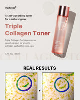 MEDICUBE Triple Collagen Toner 140 ml - Feel You